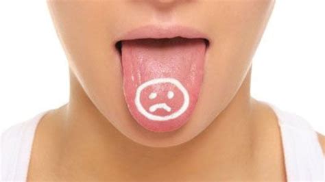 tirez la langue au médecin