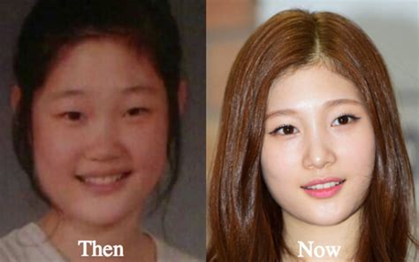 10 Famous Korean Celebrities Who Have Had Plastic Surgery Reelrundown