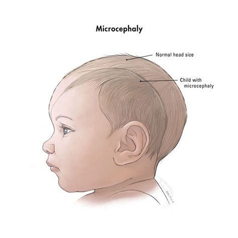 Babys Head Measuring 2 Weeks Behind Naturalhairarttutorial