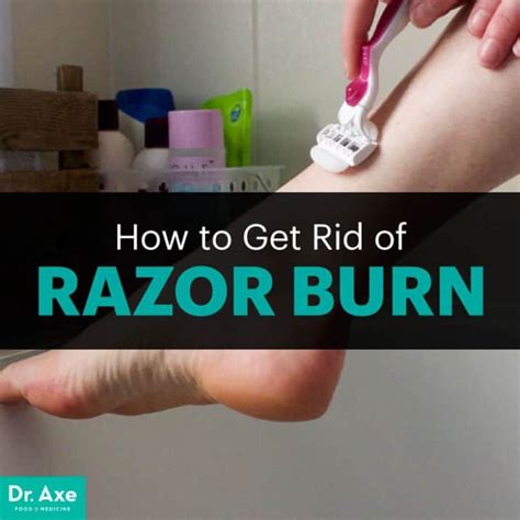 Get Rid Of Razor Burn Or Bumps Naturally In 2020 Razor Burns Razor