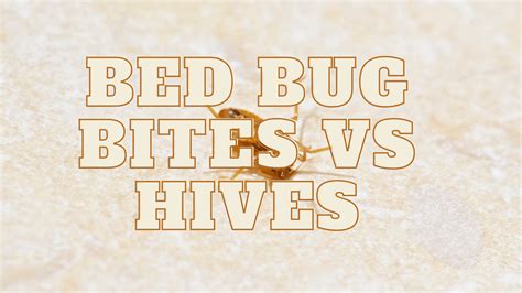 Bed Bug Bites Vs Hives How To Differentiate Between Them Bed Bugs World