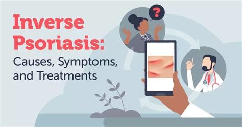 Inverse Psoriasis Causes Symptoms And Treatments Mypsoriasisteam