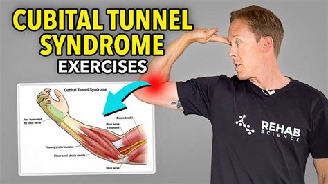 3 Exercises For Cubital Tunnel Syndrome Ulnar Nerve Rehab Youtube