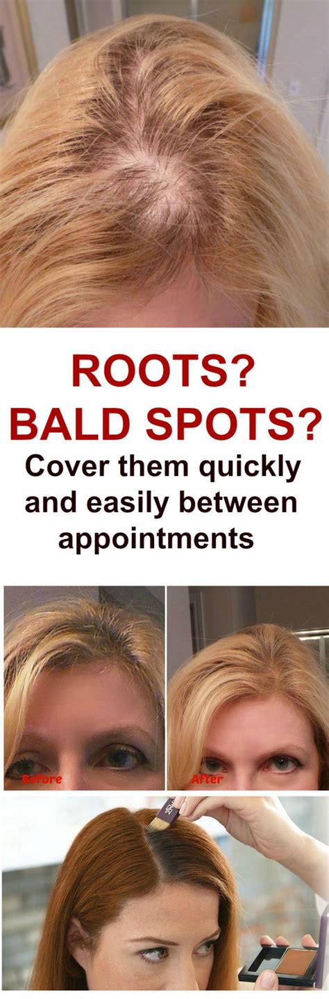 How Do I Cover Bald Spots How To Cover Roots Bald Spot Cover Roots