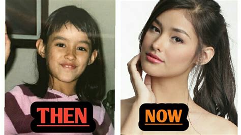 Filipino Celebrities Before And After