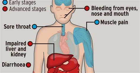 •the average ebola case fatality rate is around 50%. Ebola virus: What is it and how does it spread? - Mirror ...