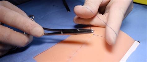 Subcuticular Suture Osce Guide Surgical Skills Geeky Medics