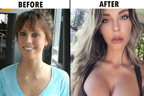Is Chloe Lattanzi Married Also Know About Her Plastic Surgery