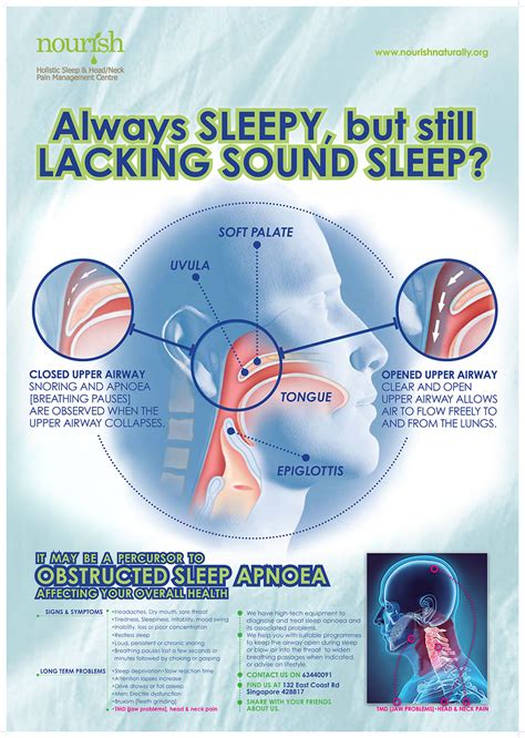 What Is Sleep Apnoea Do You Suffer From It Nourish Dental And Tmj Care