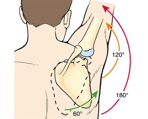 Shoulder Impingement Rehab Guide Precision Movement