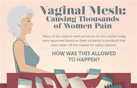 Vaginal Mesh Infographic Only Infographic