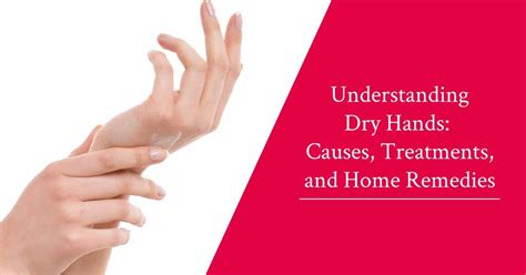 The Best Remedies For Dry Hands