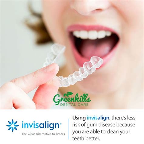 We did not find results for: Pin by Greenhills Dental on Greenhills Invisalign | Braces ...