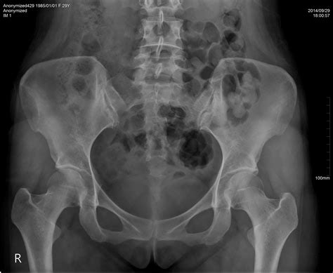 Extract lower portion of image. Image Aquisition software for human medical x-rays | Imex ...
