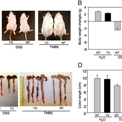 Spak Tg Mice Were More Susceptible To Dss And Tnbs Induced Mouse