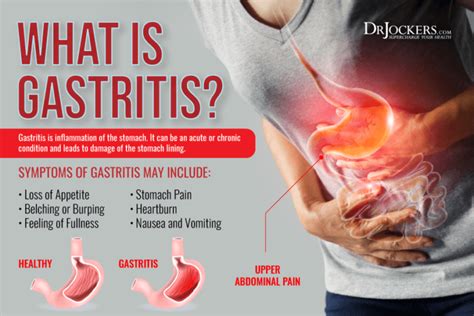 Gastritis Symptoms Causes And Support Strategies