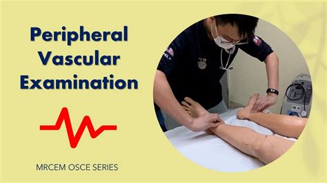 Mrcem Osce Peripheral Vascular Examination Youtube