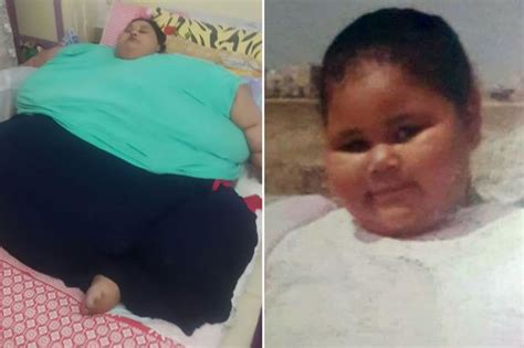 World S Fattest Woman Pictured Lying In Bed After Life Saving Weight Loss Surgery Reduces