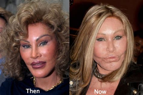 Jocelyn Wildenstein Plastic Surgery Before And After Photos