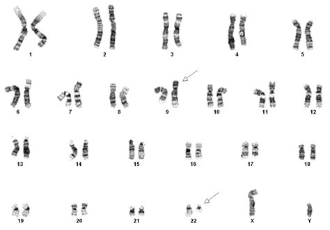 karyotype profile of a person s chromosomes hot sex picture