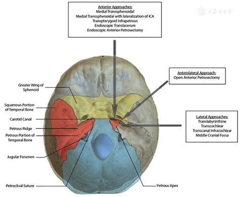 Surgical Approaches To The Petrous Apex World Journal Of