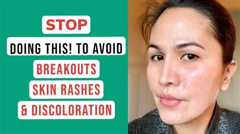 Skin Hygiene 7 Tips To Avoid Skin Break Outs Skin Rashes And Skin