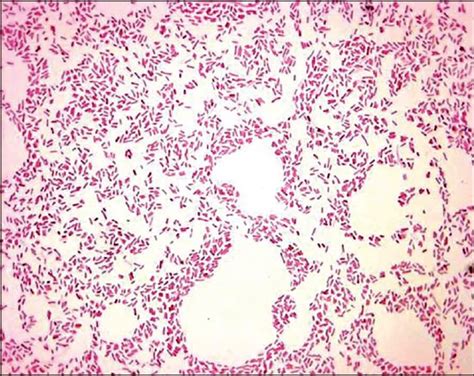 Laboratory Perspective Of Gram Staining And Its Significance In