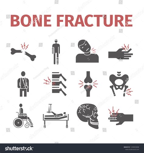 Bone Fractures Icons Treatment Infographic Illustrations Stock