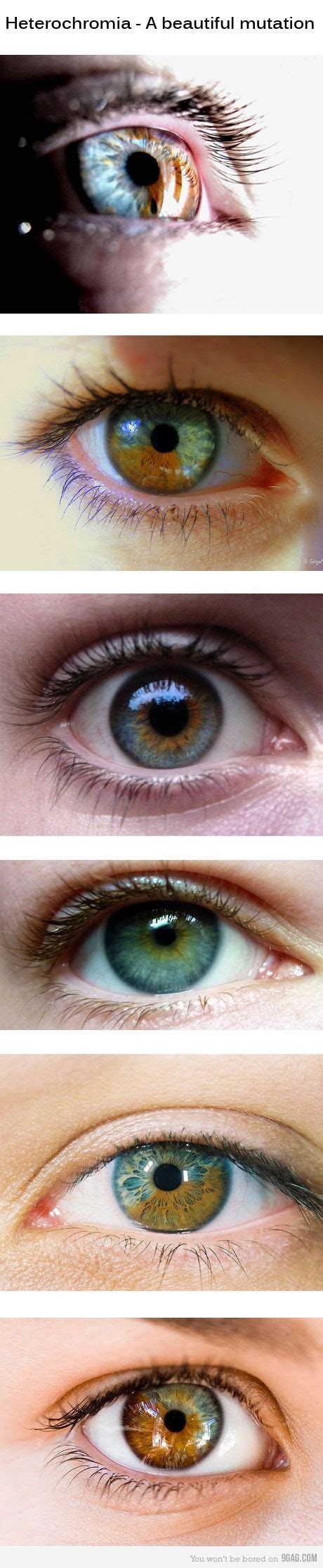 Heterochromia A Beautiful Mutation Of The Iris Pretty Eyes Cool Eyes Beautiful Eyes