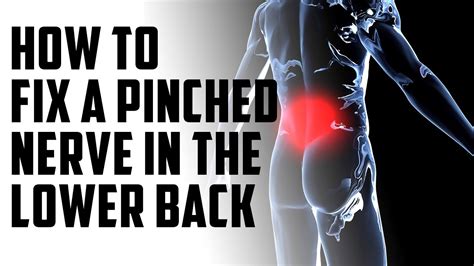 How To Fix A Pinched Nerve In The Lower Back Episode 14 Youtube