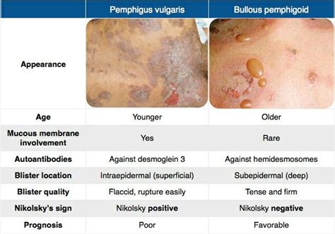 Pemphigus Vulgaris Vs Bullous Pemphigoid Nursing Study Tips Urgent