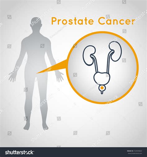 Prostate Cancer Vector Logo Icon Illustration Stock Vector Royalty Free Shutterstock