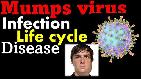 Mumps Virus Pathogenesis Symptoms And Treatment Youtube