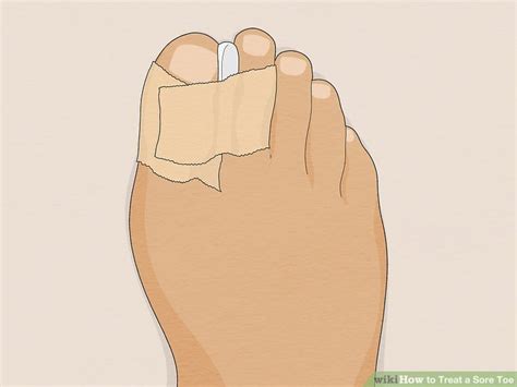 13 Ways To Treat A Sore Toe Wikihow