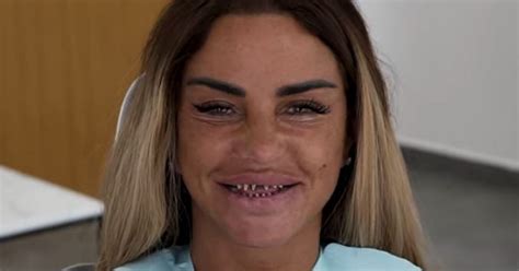 Katie Price Shares Scary Video Of Her Teeth Shaved Down To Pegs As