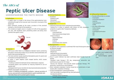 Abcs Of Peptic Ulcer Disease Surgical Interest Group Of Monash