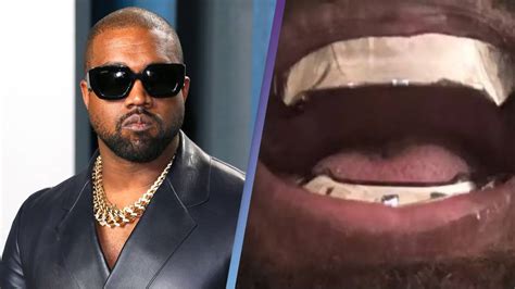 Kanye Wests Titanium Teeth Leave People Wondering How Hell Clean Them