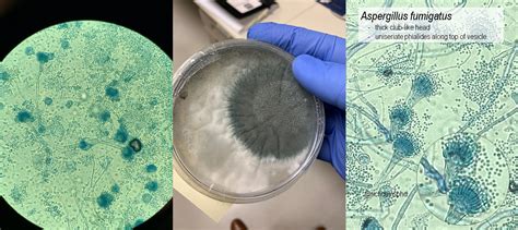 Aspergillus Fumigatus Aspergillus Fumigatus And Aspergillosis