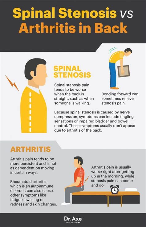 Spinal Stenosis Symptoms Causes And Treatments Dr Axe Spinal