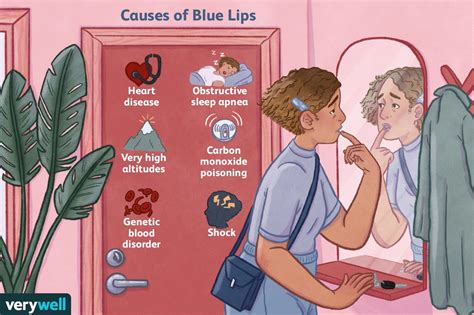 blue lips characteristics causes diagnosis and treatment