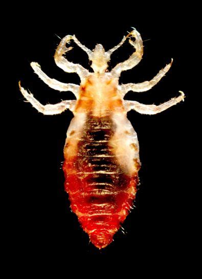 Free Picture Dorsal View Insect Body Louse Pediculus Humanus