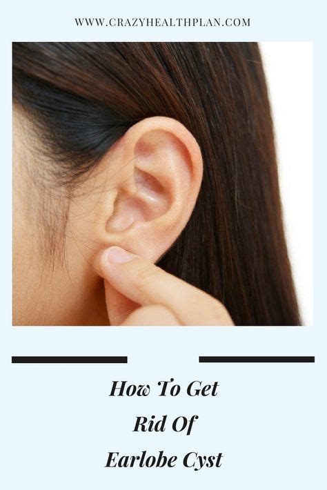 How To Get Rid Of Earlobe Cyst Cysts Ear Pimple Essential Oils For