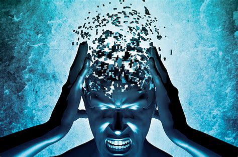 ‘exploding Head Syndrome Is No Joke Ailment Is Surprisingly Common