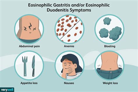 Eosinophilic Gastritis Andor Eosinophilic Duodenitis Causes Symptoms