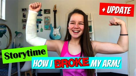 Update How I Broke My Arm Storytime Youtube