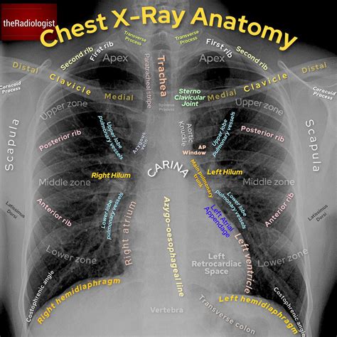 Normal Chest X Ray Labeled Hot Sex Picture