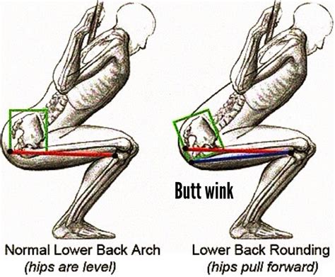 Lower Back Pain After Your Squats You May Have A Butt Wink Fit Tip