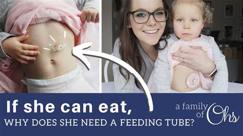 She Can Eat Why Does She Need A Feeding Tube Youtube