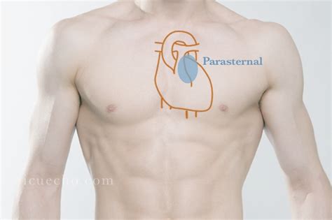 Parasternal Short Axis Icu And Echo