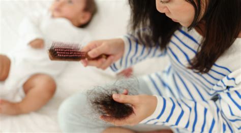 Postpartum Hair Loss Causes Management And Tips Hk Vitals